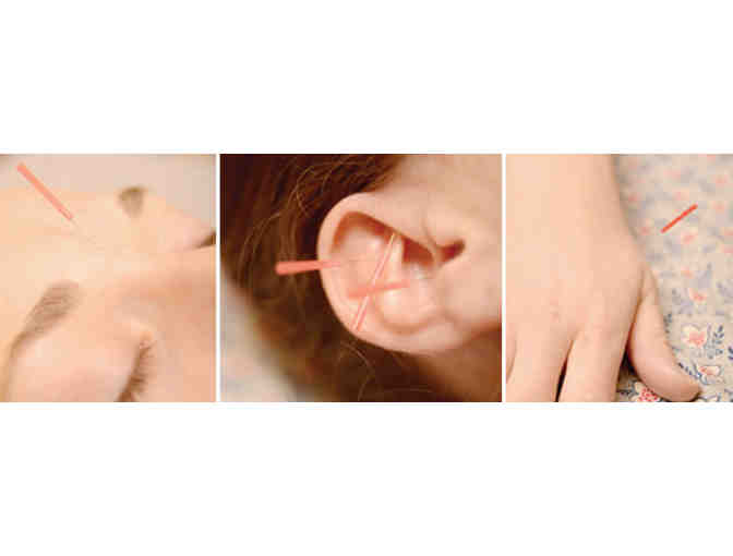 Heal and Cleanse with Acupuncture Treatment (1 Session)
