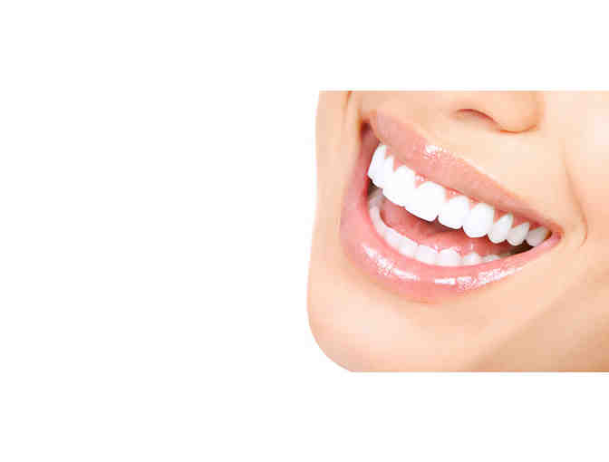Professional Take-Home Teeth Whitening System