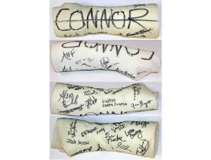 Arm cast from Dear Evan Hansen, signed by Andrew Barth Feldman and full Broadway company