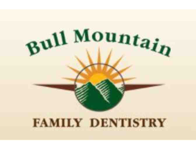 Teeth Whitening - KOR with Bull Mountain Family Dental