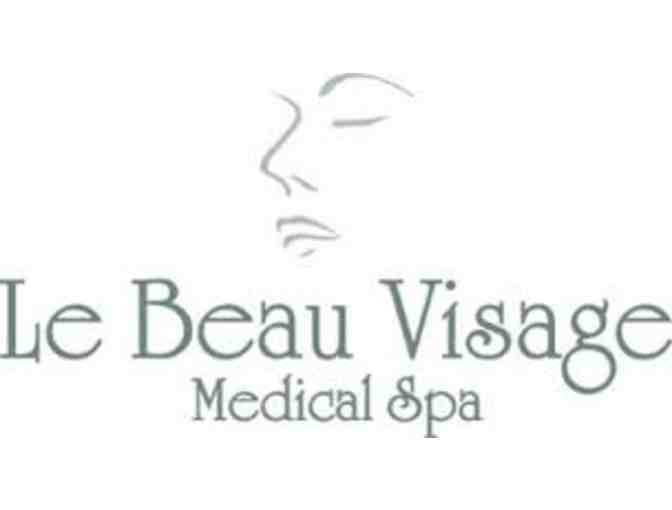 Le Beau Visage - Personalized Consultation & Microdermabrasion/Chemical Peel