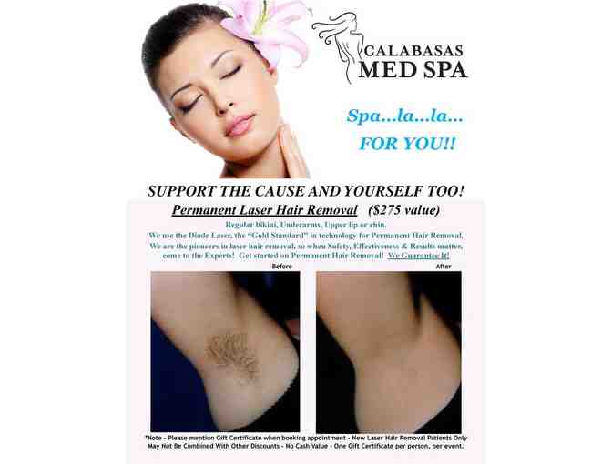 Calabasas Med Spa Permanent Laser Hair Removal ($275 Value)