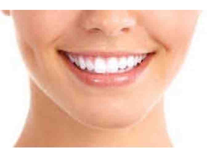 Teeth Whitening Package