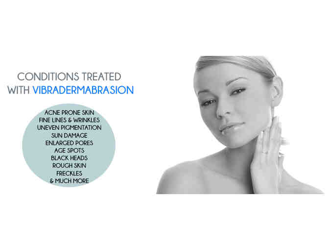 Facial Microdermabrasion (Vibraderm) - 5 Treatments