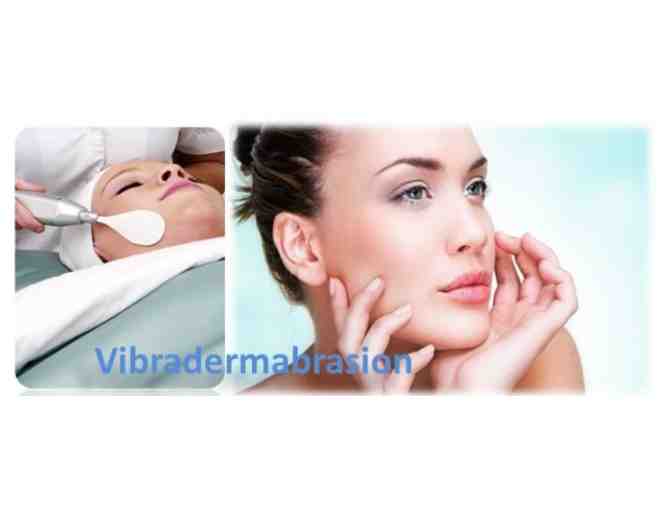 Facial Microdermabrasion (Vibraderm) - 3 Treatments