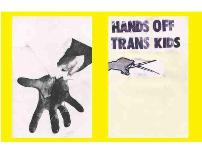 Hands Off Trans Kids - Photo 3