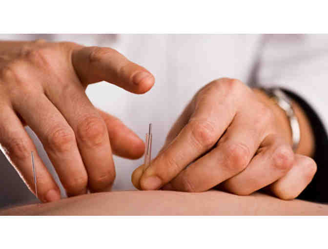 90 Minute New Patient Consultation & Acupuncture Treatment