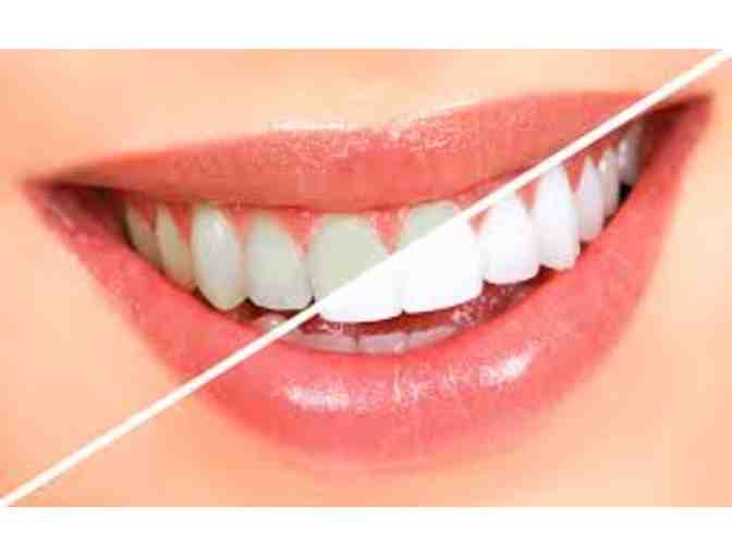 Teeth Whitening and Manicure