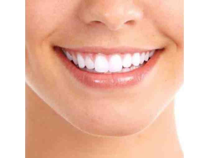 Pristine Teeth Whitening