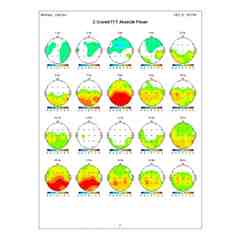 JoAnna Strong, LPC, EEG Board Certified, BCIA