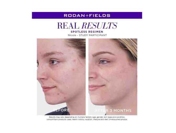 Rodan + Fields: Spotless Regimen