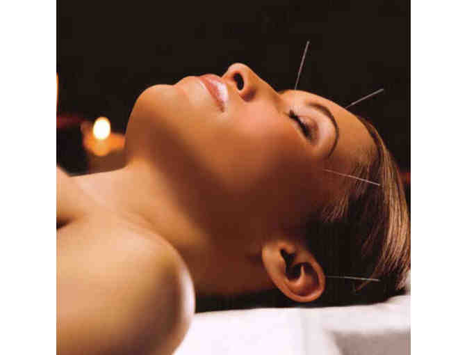 Acupuncture Treatment with Ruth Schlesinger