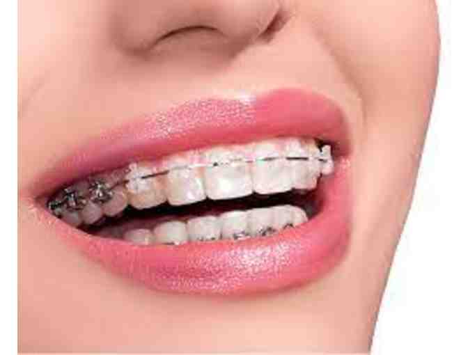 Wicker Park Orthodontics: $500 Off Comprehensive Braces or Invisalign Treatment