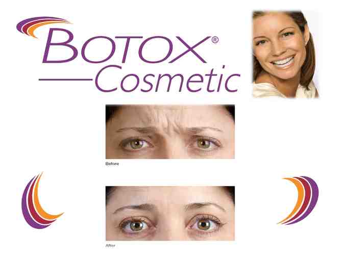 Botox Cosmetic in Pasadena