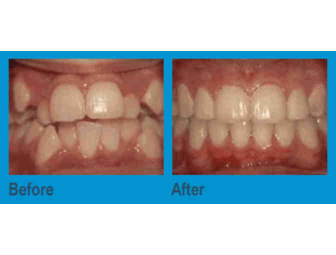 Palm Beach Orthodontics - $1500 towards 'Comprehensive Orthodontic Treatment'