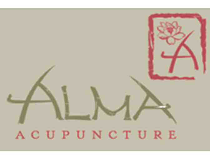 Accupuncture Treatment