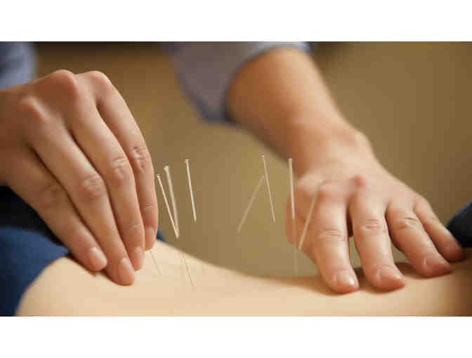 60-Minute Japanese Acupuncture Relax and Rebalance Session with Mariola Strahlberg