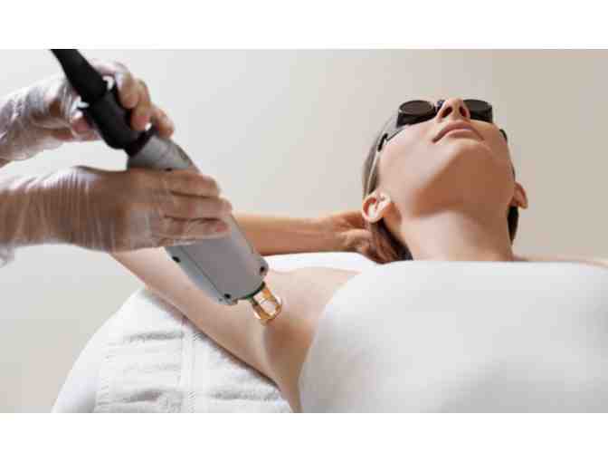 Stretch Mark Removal, Laser Hair Removal, Scar Removal, or IPL for Face