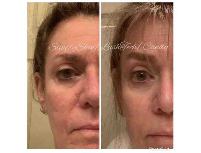 Simply Skin/ LashTech Gift Basket