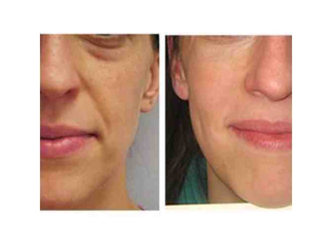 Skin Rejuvenation Clinic - $120 in Beauty Bucks