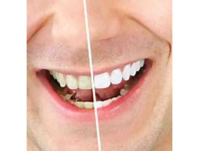 Zoom! Teeth Whitening by Dr. Glenn Zeleznick