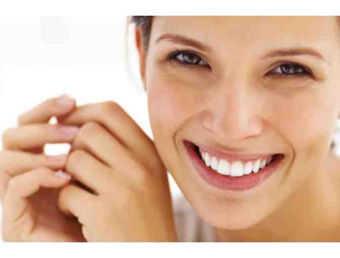 Professional Teeth Whitening with Exam and More!
