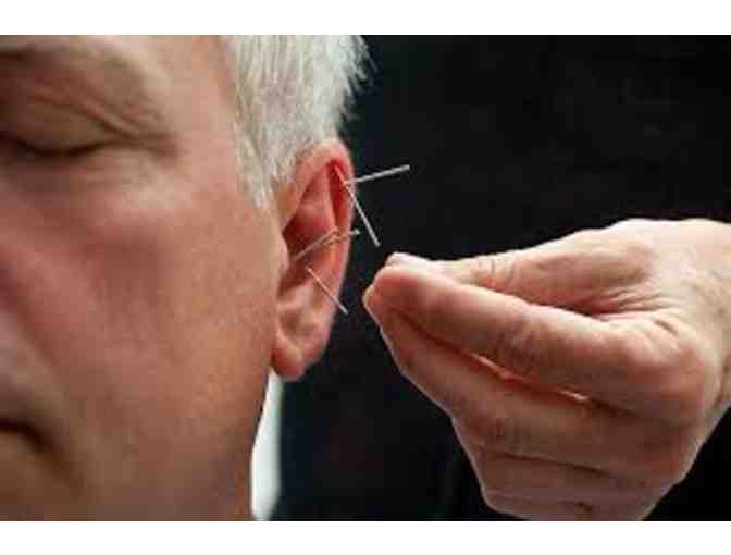 Acupuncture for Humans: One Session