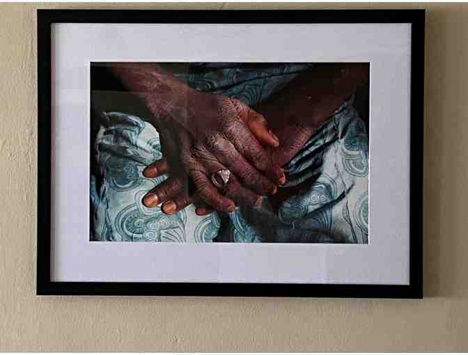 'Hands' by Patrick Meinhardt - Framed International Medical Corps Photo