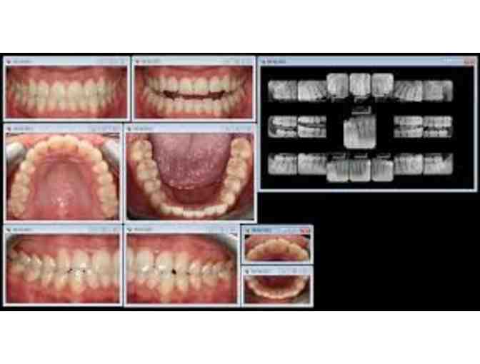 A full mouth x-ray, teeth whitening & a full hygiene appointment at Carlston Dental Group