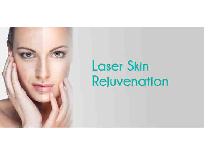 3 Laser Rejuvenation Sessions with one of Hollywood's top doctors, Dr. Alan Rosenbach - Photo 1