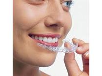 invisalign clear removable braces