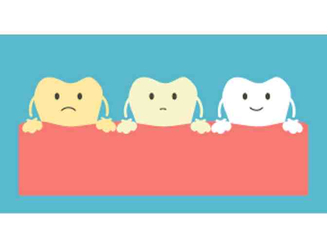 Ideal Dental - Teeth whitening treatment
