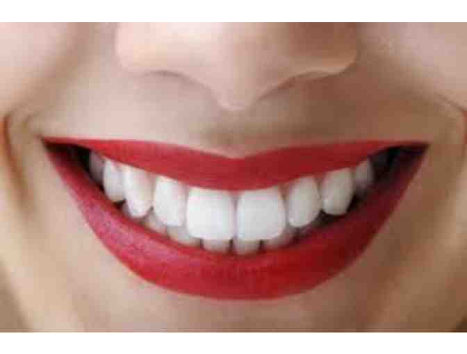 Teeth Whitening, Dental Exam & X-rays with Top-Rated Dr. Andrea Henderson, DDS