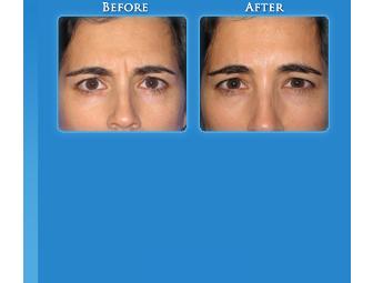 One Botox Treatment by Dr. Andrew T. Cohen (2 areas)