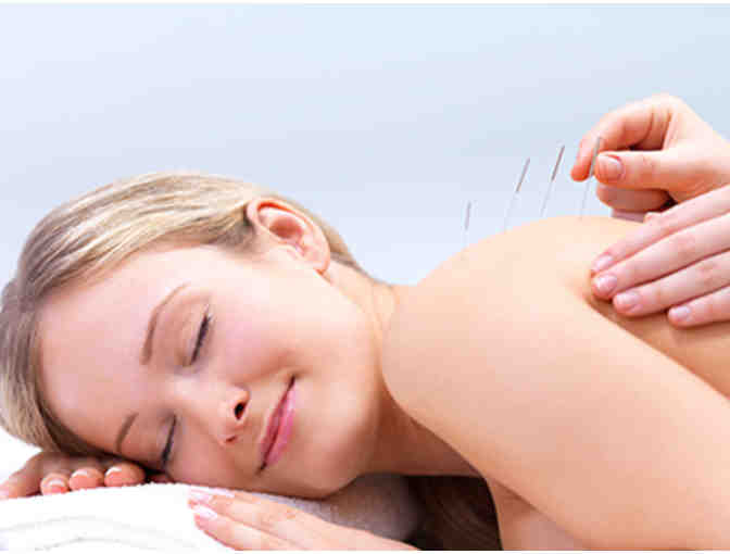 Acupuncture consultation and treatment by Katya Mosely, L.Ac.