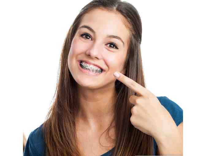 SUMMER ORTHODONTICS FULL SET OF BRACES