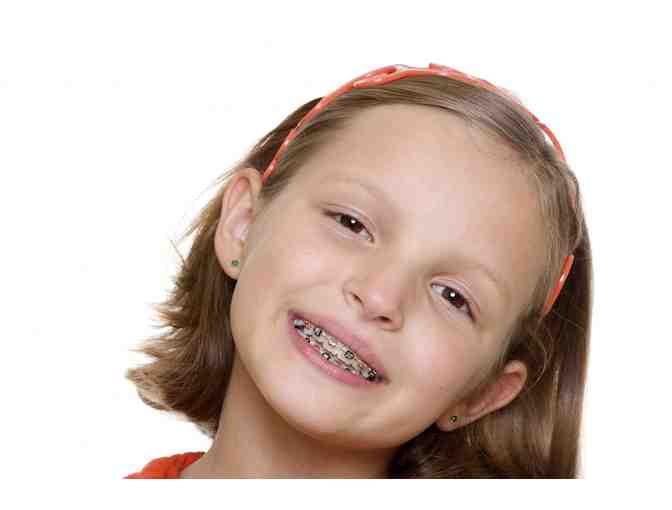 SUMMER ORTHODONTICS FULL SET OF BRACES