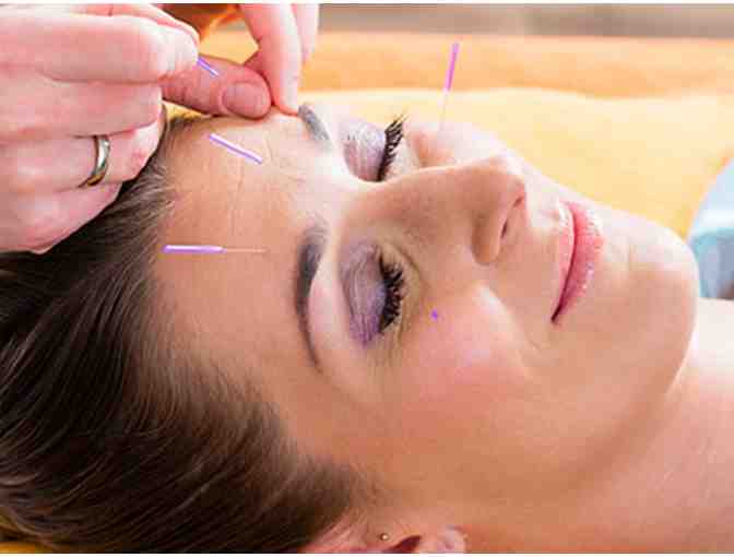 Pkg #40- 1-Year Family Zoo Membership, Acupuncture and More