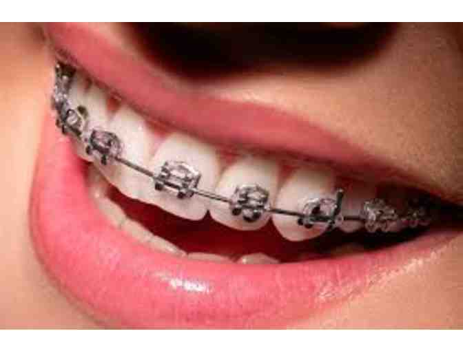 $500 Orthodontic Treatment Discount + Gift Bag