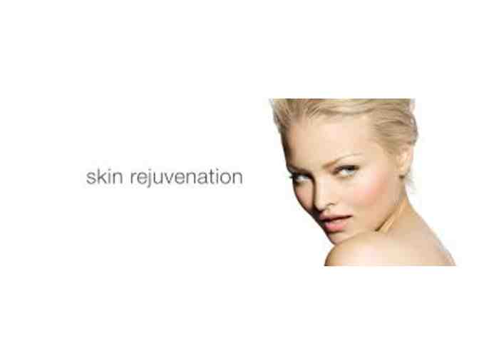 Treat Your Skin Well to 4 ThermiSmooth Skin Smoothing and Skin Rejuvenating MicroPeel