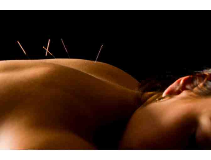 Acupuncture, Massage and/or Physical Therapy