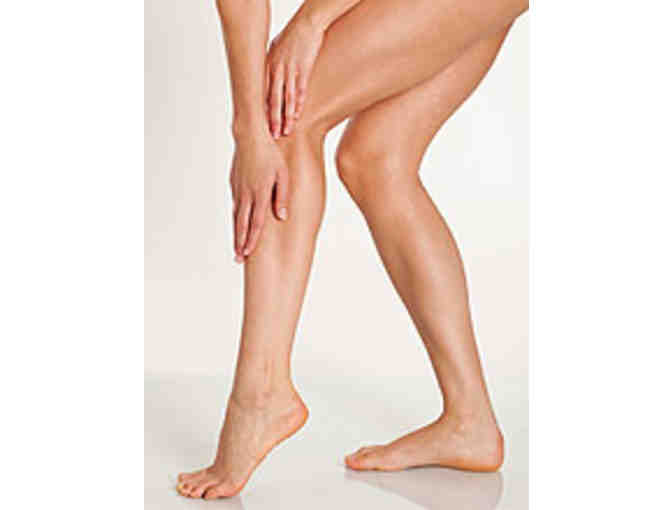 Complimentary Spider Vein treatment