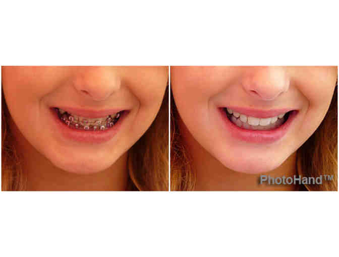 Magazine Quality Photo Retouching for 10 Photos!!