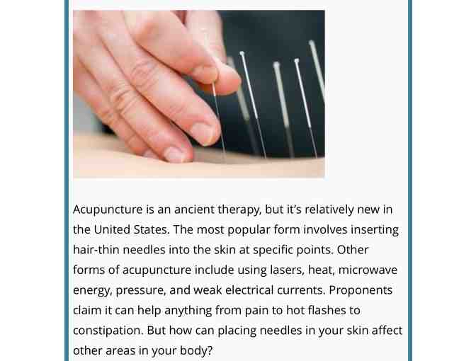 Acupuncture by Vivien Eng