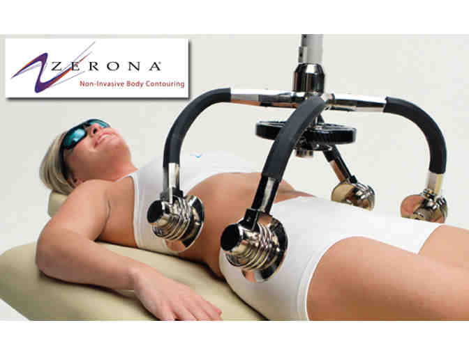 Valhalla Wellness: Zerona Lipo Laser Treatments Package of 3