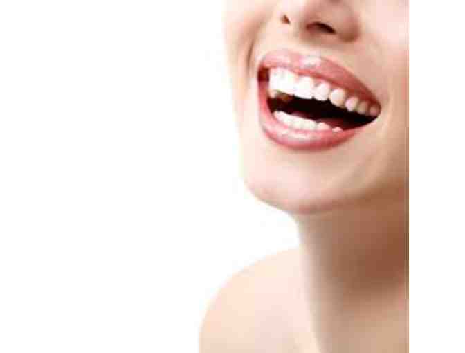 Starr Smiles Teeth Whitening - $200 Gift Voucher