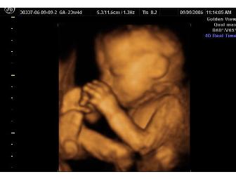 Goldenview Picture Perfect 3D/4D Ultrasound Session