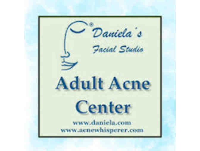 Adult Acne analysis w/ 1 full size cleanser & 1 full size toner at Daniela's Facial Studio