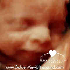 GoldenView Ultrasound 3D/4D
