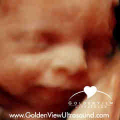 GoldenView Ultrasound 3D/4D
